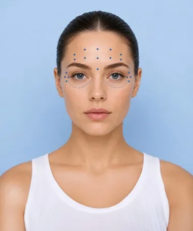 Botox® Basics